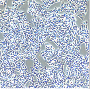 小鼠黑色素瘤细胞B16