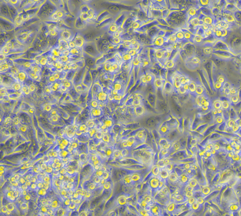 NCI-H2405�˷�Сϸ���ΰ�ϸ��