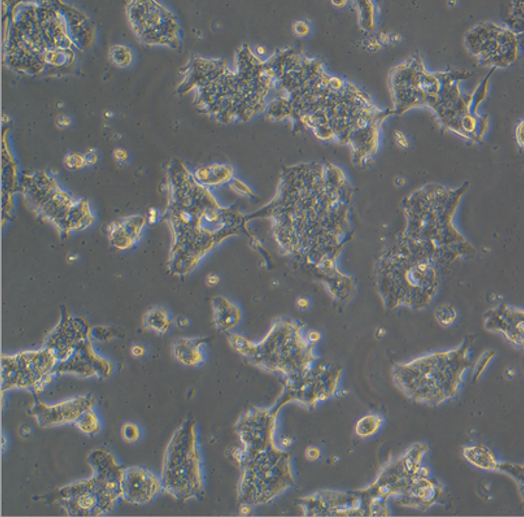 �˷�Сϸ���ΰ�ϸ��NCI-H1435��STR������ȷ��